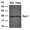 Rac Family Small GTPase 1 antibody, orb14592, Biorbyt, Western Blot image 