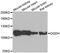 2-oxoglutarate dehydrogenase, mitochondrial antibody, A6391, ABclonal Technology, Western Blot image 
