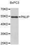 Pancreatic Lipase antibody, abx007143, Abbexa, Western Blot image 