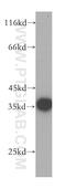 Coproporphyrinogen Oxidase antibody, 16724-1-AP, Proteintech Group, Western Blot image 