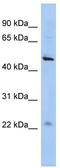 Chromosome 12 Open Reading Frame 50 antibody, TA338879, Origene, Western Blot image 