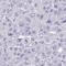 Zinc Finger Protein 221 antibody, HPA059435, Atlas Antibodies, Immunohistochemistry paraffin image 