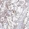 Glycerate Kinase antibody, FNab03510, FineTest, Immunohistochemistry paraffin image 