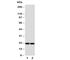 Pulmonary surfactant-associated protein C antibody, R31033, NSJ Bioreagents, Western Blot image 