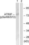 ATR Interacting Protein antibody, LS-C198657, Lifespan Biosciences, Western Blot image 
