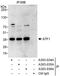 Cyclic AMP-dependent transcription factor ATF-1 antibody, A303-035A, Bethyl Labs, Immunoprecipitation image 