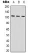 Actinin Alpha 1 antibody, LS-C413602, Lifespan Biosciences, Western Blot image 