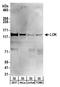 Serine/threonine-protein kinase 10 antibody, A300-400A, Bethyl Labs, Western Blot image 