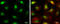 Deoxycytidine kinase antibody, GTX102800, GeneTex, Immunofluorescence image 