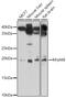 Mitochondrial Ribosomal Protein L48 antibody, 18-319, ProSci, Western Blot image 