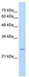 Immediate Early Response 2 antibody, TA335733, Origene, Western Blot image 