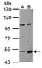 Fatty aldehyde dehydrogenase antibody, GTX110363, GeneTex, Western Blot image 