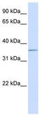 Aldolase, Fructose-Bisphosphate C antibody, TA346597, Origene, Western Blot image 