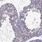 Zinc Finger Protein 646 antibody, HPA066468, Atlas Antibodies, Immunohistochemistry paraffin image 