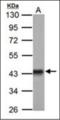Gamma-Glutamyltransferase 1 antibody, orb101165, Biorbyt, Western Blot image 