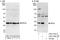 Ribosomal Protein S2 antibody, A303-793A, Bethyl Labs, Immunoprecipitation image 