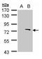 Zinc Finger MYND-Type Containing 11 antibody, GTX103403, GeneTex, Western Blot image 