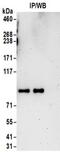 Holocarboxylase Synthetase antibody, NBP2-32174, Novus Biologicals, Immunoprecipitation image 