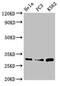 Proteasome Subunit Alpha 1 antibody, CSB-PA018865LA01HU, Cusabio, Western Blot image 