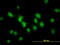 SMAD Family Member 1 antibody, LS-C133299, Lifespan Biosciences, Immunofluorescence image 