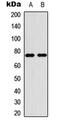 Protein Inhibitor Of Activated STAT 4 antibody, abx121552, Abbexa, Western Blot image 