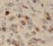 S100A8 antibody, FNab07564, FineTest, Immunohistochemistry frozen image 