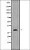 HLA class II histocompatibility antigen, DQ alpha 1 chain antibody, orb378102, Biorbyt, Western Blot image 