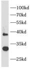 Interleukin 1 Receptor Like 1 antibody, FNab08261, FineTest, Western Blot image 