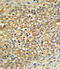 UDP-glucuronosyltransferase 2B17 antibody, abx032833, Abbexa, Immunohistochemistry paraffin image 