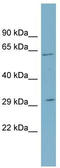 Steroid 5 Alpha-Reductase 2 antibody, TA335223, Origene, Western Blot image 