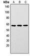 LYN Proto-Oncogene, Src Family Tyrosine Kinase antibody, abx121639, Abbexa, Western Blot image 