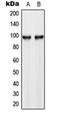 Hexokinase 3 antibody, orb216127, Biorbyt, Western Blot image 