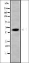 Dedicator Of Cytokinesis 11 antibody, orb338228, Biorbyt, Western Blot image 