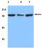 ATP Binding Cassette Subfamily B Member 10 antibody, PA5-75389, Invitrogen Antibodies, Western Blot image 