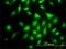 Rap Guanine Nucleotide Exchange Factor 6 antibody, H00051735-M01, Novus Biologicals, Immunocytochemistry image 