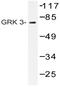 G Protein-Coupled Receptor Kinase 3 antibody, AP20381PU-N, Origene, Western Blot image 
