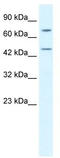 Kelch Like Family Member 25 antibody, TA335481, Origene, Western Blot image 