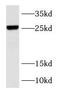 RAB37, Member RAS Oncogene Family antibody, FNab07020, FineTest, Western Blot image 