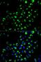 Acid Phosphatase 1 antibody, orb135000, Biorbyt, Immunofluorescence image 