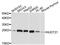 Nudix Hydrolase 21 antibody, A4482, ABclonal Technology, Western Blot image 