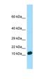 Putative coiled-coil domain-containing protein 26 antibody, orb326554, Biorbyt, Western Blot image 