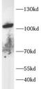 Transient receptor potential cation channel subfamily V member 1 antibody, FNab10732, FineTest, Western Blot image 