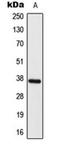 Elongation of very long chain fatty acids protein 4 antibody, orb224014, Biorbyt, Western Blot image 