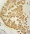 Probable palmitoyltransferase ZDHHC21 antibody, 61-818, ProSci, Immunohistochemistry frozen image 