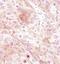 Fibroblast Growth Factor Receptor 3 antibody, MA5-14843, Invitrogen Antibodies, Immunohistochemistry paraffin image 