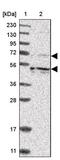 Kinesin Family Member 12 antibody, PA5-54987, Invitrogen Antibodies, Western Blot image 