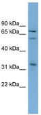 T-Box 18 antibody, TA342416, Origene, Western Blot image 
