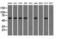 Thromboxane A Synthase 1 antibody, M04697, Boster Biological Technology, Western Blot image 