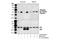 FYN Proto-Oncogene, Src Family Tyrosine Kinase antibody, 2101L, Cell Signaling Technology, Western Blot image 
