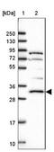 Protein Kinase AMP-Activated Non-Catalytic Subunit Beta 2 antibody, NBP1-92286, Novus Biologicals, Western Blot image 